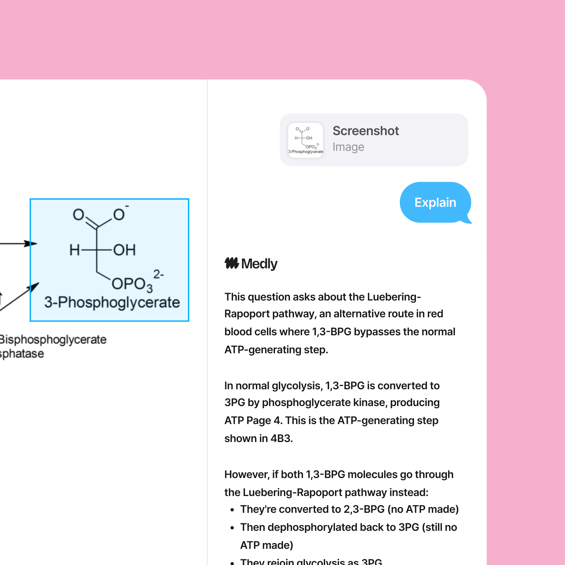 Understanding feature